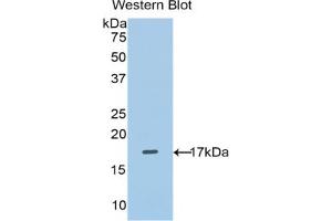 Western blot analysis of the recombinant protein. (SLC3A2 antibody  (AA 270-406))