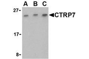 Image no. 1 for anti-C1q and Tumor Necrosis Factor Related Protein 7 (C1QTNF7) (C-Term) antibody (ABIN207822) (CTRP7 antibody  (C-Term))
