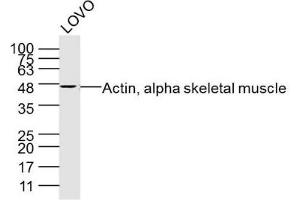 LoVo lysates probed with Actin, alpha skeletal muscle Polyclonal Antibody, Unconjugated  at 1:300 dilution and 4˚C overnight incubation. (Actin antibody)