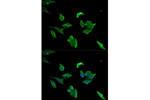 Immunofluorescence (IF) image for anti-Lymphocyte Cytosolic Protein 1 (LCP1) antibody (ABIN1876741) (LCP1 antibody)