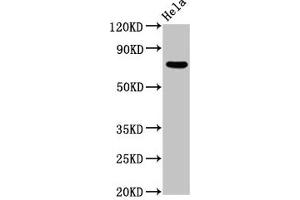 Western Blot Positive WB detected in: Hela whole cell lysate All lanes: MTMR2 antibody at 5. (MTMR2 antibody  (AA 1-173))