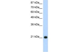 Western Blotting (WB) image for anti-Ribosomal Protein L9 (RPL9) antibody (ABIN2462051) (RPL9 antibody)