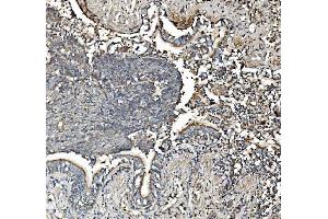 IHC analysis of Prohibitin/PHB using anti-Prohibitin/PHB antibody (ABIN7599170).