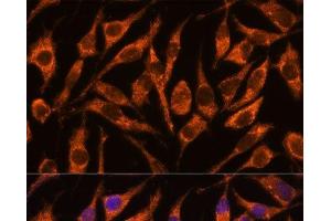 Immunofluorescence analysis of L929 cells using SNX15 Polyclonal Antibody at dilution of 1:100.