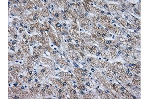 Immunohistochemical staining of paraffin-embedded liver tissue using anti-ATP5B mouse monoclonal antibody.