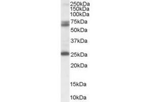 ABIN185388 (0. (GAD65 antibody  (Internal Region))