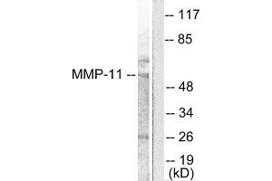 Western Blotting (WB) image for anti-Matrix Metallopeptidase 11 (Stromelysin 3) (MMP11) (Internal Region) antibody (ABIN1848672) (MMP11 antibody  (Internal Region))