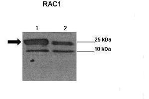 Sample Type: Lane 1:241 µg siRUVBL1 transfected human H1299 cells Lane 2: 041 µg untransfected human H1299 cells Primary Antibody Dilution: 1:0000Secondary Antibody: Anti-rabbit-HRP Secondary Antibody Dilution: 1:0000 Color/Signal Descriptions: RAC1  Gene Name: Wenwei Hu, Xuetian Yue, Rutgers Cancer Institute of New Jersey. (RAC1 antibody  (Middle Region))
