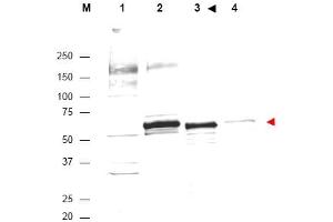 Image no. 1 for anti-V-Akt Murine Thymoma Viral Oncogene Homolog 1 (AKT1) (Internal Region) antibody (ABIN401484) (AKT1 antibody  (Internal Region))