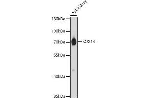 Western blot analysis of extracts of Rat kidney, using SOX13 antibody (ABIN7270570) at 1:1000 dilution. (SOX13 antibody  (AA 1-180))
