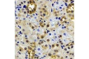 Immunohistochemical analysis of ADH4 staining in rat kidney formalin fixed paraffin embedded tissue section. (ADH4 antibody)