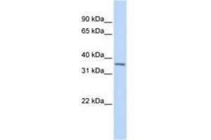 Image no. 1 for anti-T-Cell Leukemia Homeobox 1 (TLX1) (AA 144-193) antibody (ABIN6741503) (TLX1 antibody  (AA 144-193))
