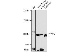 Western blot analysis of extracts of various cell lines, using PKP2 antibody (ABIN1876693) at 1:1000 dilution. (Plakophilin 2 antibody)