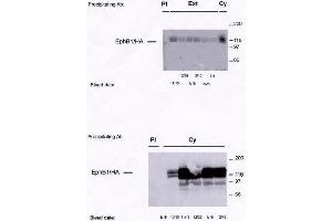Image no. 1 for anti-EPH Receptor B1 (EPHB1) antibody (ABIN264959) (EPH Receptor B1 antibody)