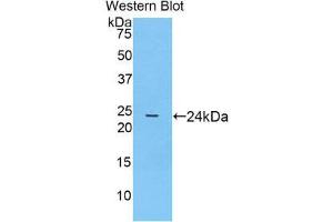 Western Blotting (WB) image for anti-Prostaglandin-Endoperoxide Synthase 1 (Prostaglandin G/H Synthase and Cyclooxygenase) (PTGS1) (AA 407-602) antibody (ABIN1860352) (PTGS1 antibody  (AA 407-602))