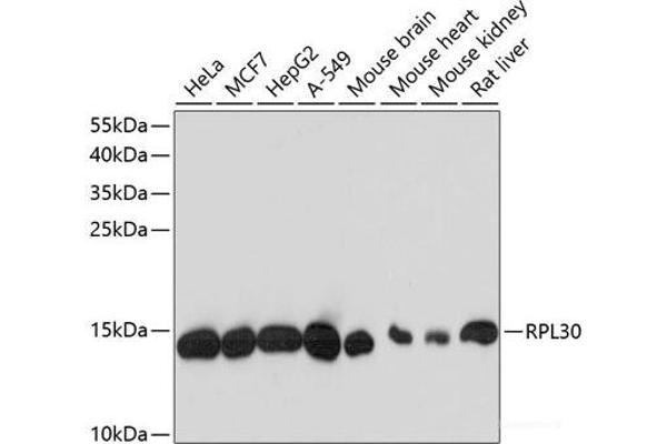RPL30 anticorps