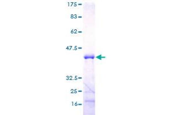 MED21 Protein (AA 1-144) (GST tag)