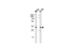Western blot analysis of lysates from Hela, SiHa cell line (from left to right), using SNAI1 Antibody (N-term R8) (ABIN388812 and ABIN2839130). (SNAIL antibody  (N-Term))