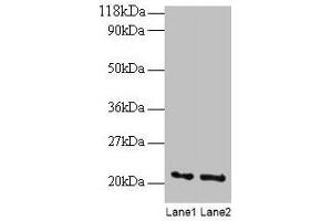 Western blot All lanes: ARF4 antibody at 2 μg/mL Lane 1: EC109 whole cell lysate Lane 2: 293T whole cell lysate Secondary Goat polyclonal to rabbit IgG at 1/15000 dilution Predicted band size: 21 kDa Observed band size: 21 kDa (ARF4 antibody  (AA 1-180))