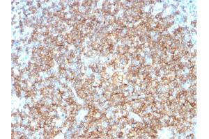 Formalin-fixed, paraffin-embedded human Tonsil stained with CD22-Monospecific Mouse Monoclonal Antibody (BLCAM/1795). (CD22 antibody  (AA 52-178))