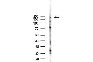 anti-Ral GTPase Activating Protein, alpha Subunit 2 (Catalytic) (RALGAPA2) (Internal Region) antibody