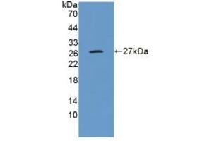 Detection of Recombinant GluAP, Human using Polyclonal Antibody to Aminopeptidase A (ENPEP) (ENPEP antibody  (AA 718-948))