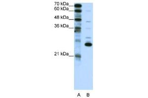 RCV1 antibody used at 2. (Recoverin antibody  (C-Term))