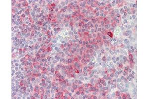 Anti-SH2D1A / SAP antibody IHC staining of human tonsil. (SH2D1A antibody  (C-Term))