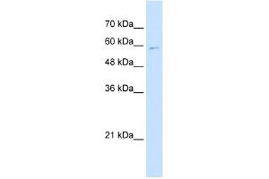 WB Suggested Anti-IRF4 Antibody Titration:  5. (IRF4 antibody  (N-Term))
