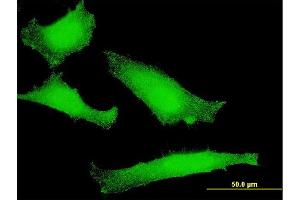 Immunofluorescence of monoclonal antibody to FOXO1 on HeLa cell. (FOXO1 antibody  (AA 556-655))