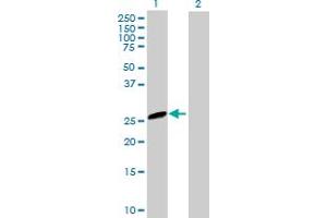 Western Blot analysis of EVI2A expression in transfected 293T cell line by EVI2A MaxPab polyclonal antibody. (EVI2A antibody  (AA 25-236))