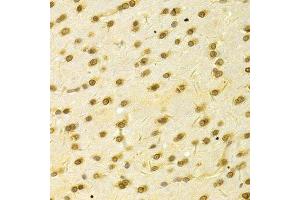 Immunohistochemistry of paraffin-embedded rat brain using HDGF Antibody.