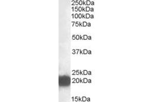 Western Blotting (WB) image for anti-Cysteine and Glycine-Rich Protein 3 (CSRP3) (Internal Region) antibody (ABIN2466624) (CSRP3 antibody  (Internal Region))