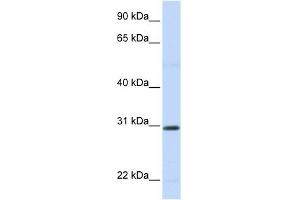 STC1 antibody used at 1 ug/ml to detect target protein. (Stanniocalcin 1 antibody  (N-Term))
