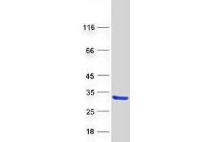 Leucine Rich Repeat Containing 20 (LRRC20) (Transcript Variant 1) protein (Myc-DYKDDDDK Tag)
