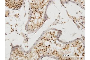 Immunoperoxidase of monoclonal antibody to ZAK on formalin-fixed paraffin-embedded human prostate.