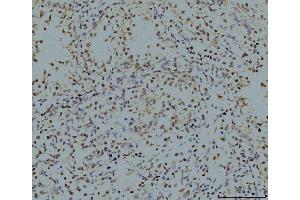 IHC analysis of LSM8 using anti-LSM8 antibody (ABIN7599578).