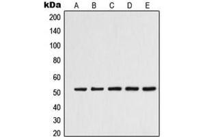 Western blot analysis of Alpha-tubulin 3C/D/E expression in K562 (A), Jurkat (B), HeLa (C), HepG2 (D), NIH3T3 (E) whole cell lysates. (alpha-Tubulin 3C/D/E (C-Term) antibody)