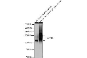Western blot analysis of extracts of HeLa cells, using A antibody (ABIN1512611, ABIN3021021, ABIN3021022, ABIN1513797 and ABIN6213916) at 1:500 dilution. (ATP1A (AA 551-850) antibody)
