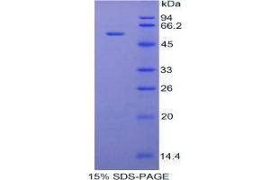 SDS-PAGE analysis of Rabbit TFPI Protein. (TFPI Protein)