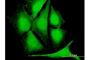 Immunofluorescence of purified MaxPab antibody to CLK1 on HeLa cell. (CLK1 antibody  (AA 1-484))