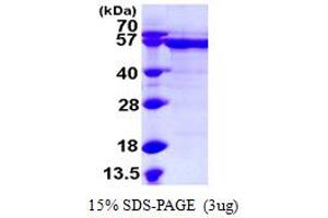 SDS-PAGE (SDS) image for RNA Guanine-7 Methyltransferase (RNMT) (AA 1-476) protein (His tag) (ABIN7279447) (RNMT Protein (AA 1-476) (His tag))