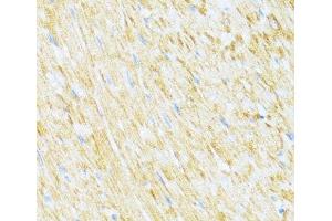Immunohistochemistry of paraffin-embedded Rat heart using UQCR10 Polyclonal Antibody at dilution of 1:100 (40x lens). (UQCR10 antibody)