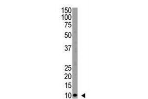 Western Blotting (WB) image for anti-Ubiquitin A-52 Residue Ribosomal Protein Fusion Product 1 (UBA52) (N-Term) antibody (ABIN5553934)