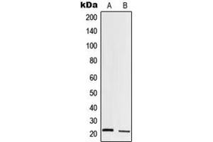Western blot analysis of Trypsin 1 expression in HT1080 (A), human pancreas (B) whole cell lysates. (PRSS1 antibody  (Center))