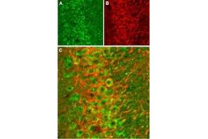 Expression of NMDA receptor 2B in rat hippocampus - Immunohistochemical staining of rat hippocampal CA1 frozen sections stained with Anti-NMDAR2B (GluN2B) (extracellular) Antibody (ABIN7043230, ABIN7044326 and ABIN7044327), (1:100). (GRIN2B antibody  (Extracellular))
