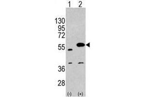 Image no. 1 for anti-Sprouty-Related, EVH1 Domain Containing 1 (SPRED1) (C-Term) antibody (ABIN356945) (SPRED1 antibody  (C-Term))