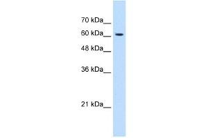 WB Suggested Anti-KIAA0319 Antibody Titration:  1.