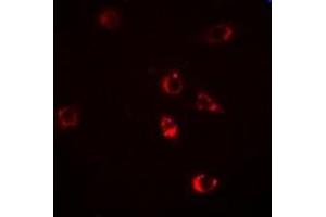 Immunofluorescent analysis of HSP47 staining in Hela cells. (SERPINH1 antibody)