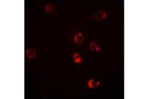 Immunofluorescent analysis of HSP47 staining in Hela cells. (SERPINH1 antibody)